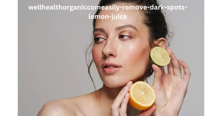 Wellhealthorganic.com/Easily Remove Dark Spots Lemon Juice